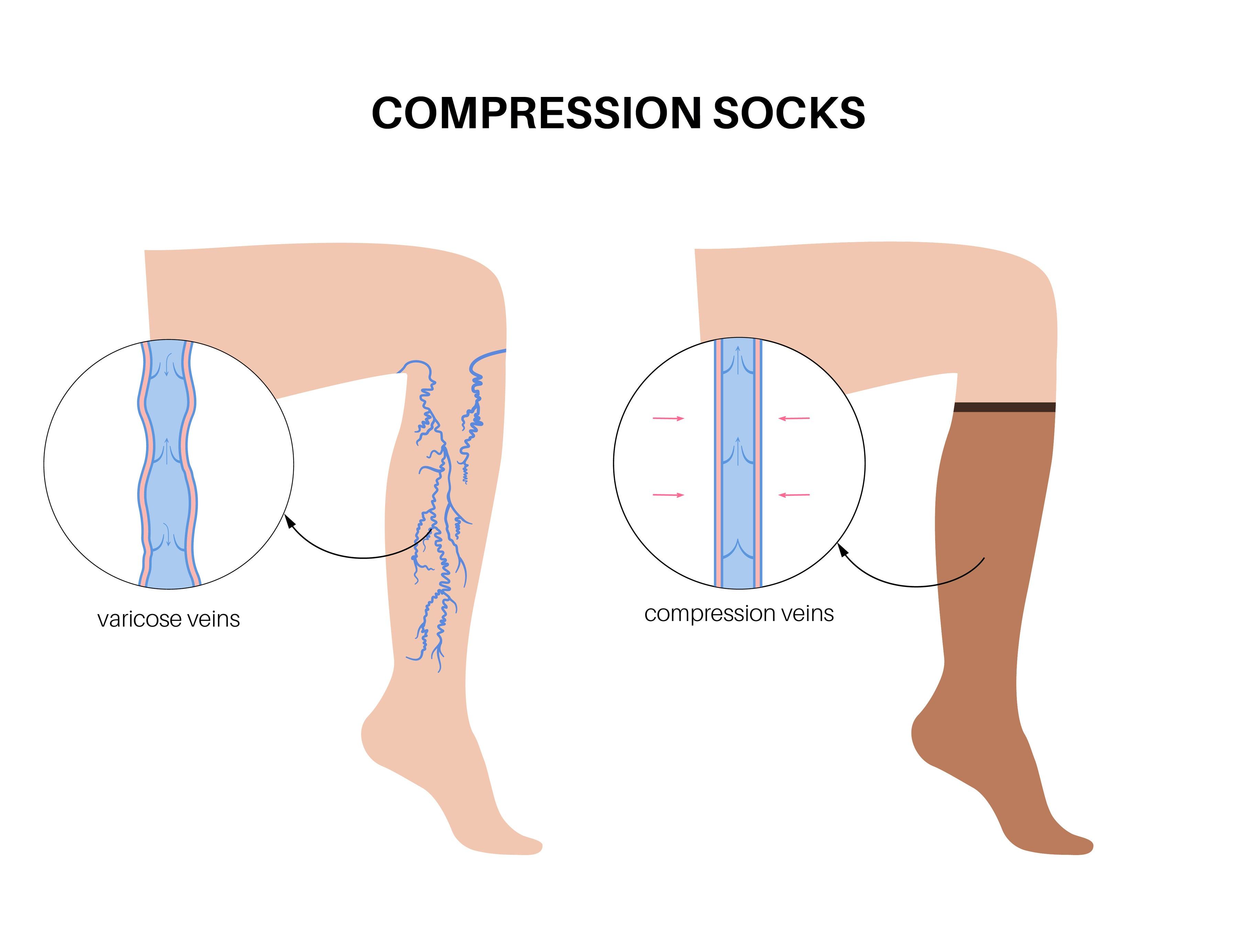 circulation socks
