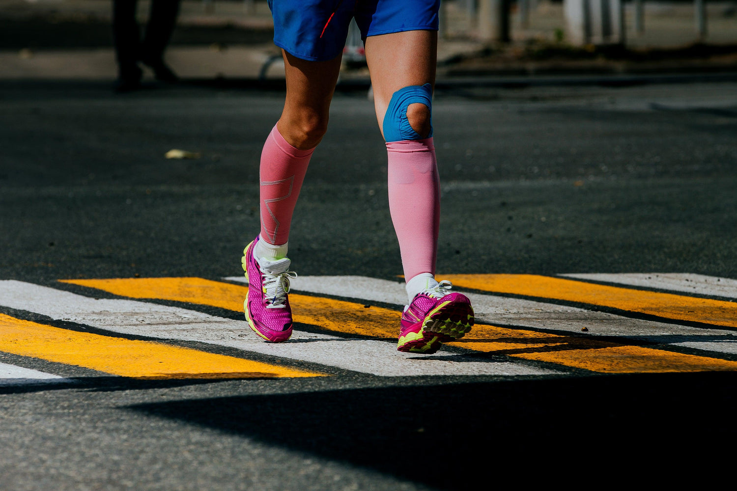 Reducing Burn Scars with Compression Garments