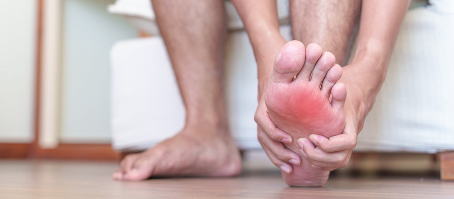 Plantar Wart Care and Prevention Tips