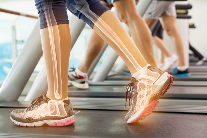 people walking on treadmill, leg and foot bones are shown