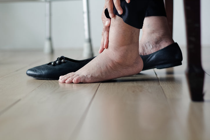 Why are Compression Socks Good for People with Diabetes?